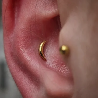 thumbnail_IMG_20240321_175216_440